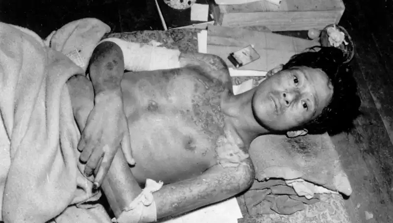80 Yıl Sonra Nagasaki'den Korkutucu Uyarı: Nükleer Tehdit Yükseliyor