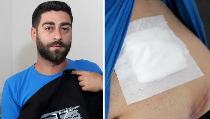 Karnında Hissettiği Ağrı, Röntgende Şok Edici Gerçeği Ortaya Çıkardı