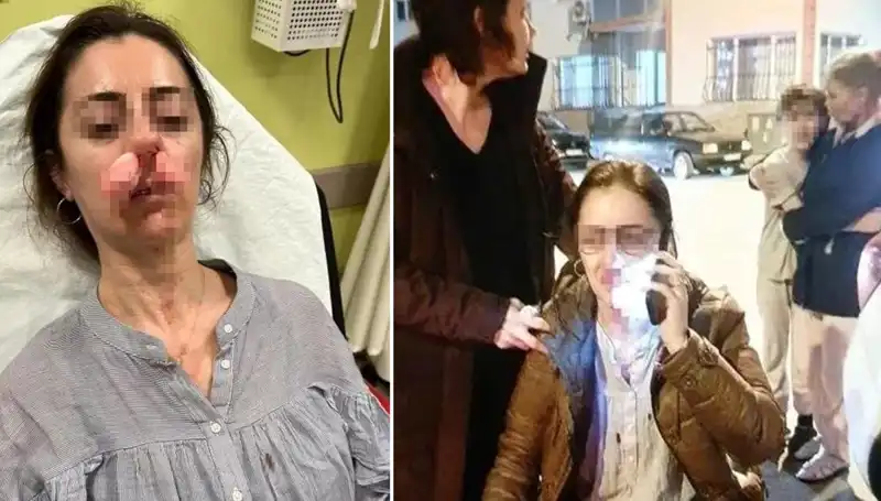 Otomobil Kapısı Silah Sayıldı! Eşinin Sevgilisini Araba Kapısıyla Darp Etti