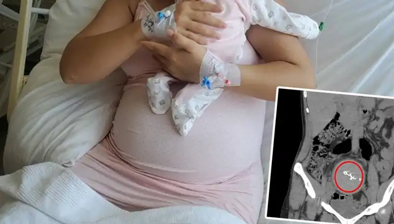 Doğumda Unutulan Bebek İki Yıl Sonra Ortaya Çıktı: Gazlı Bez İhmalde Soruşturma Başlatıldı
